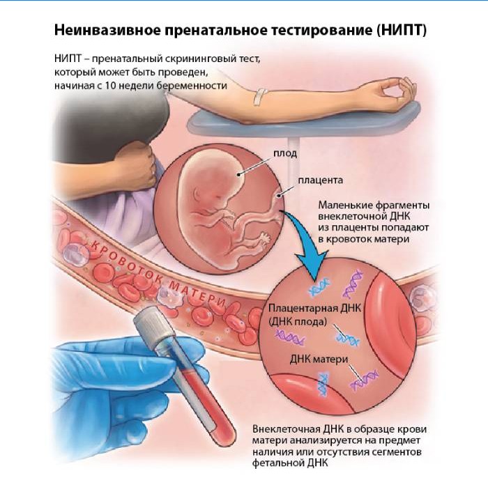 Neinvazivno prenatalno testiranje (NIPT)
