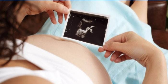 Trudnica pregledava ultrazvučni pregled